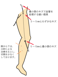 ストリッピング３