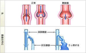 静脈弁