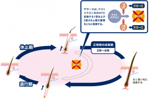 ザガーロ・プロペシアの比較