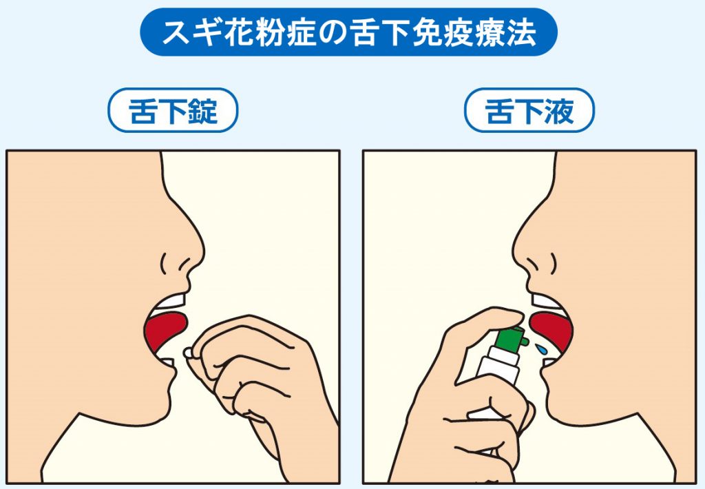 舌下免疫療法 伊藤メディカルクリニック 落合 東中野 中井 内科 外科